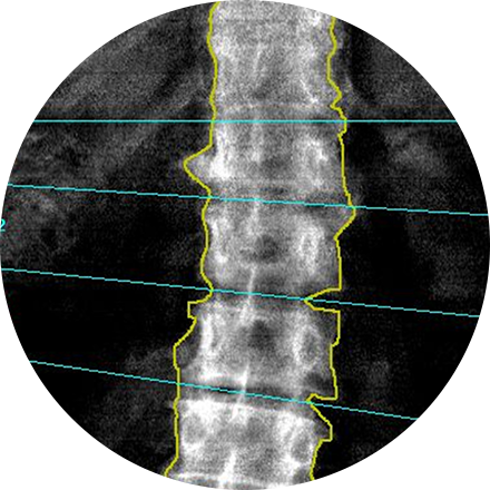 Bone Density Scan icon