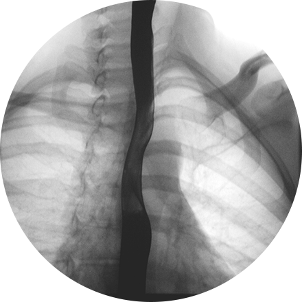 Fluoroscopy icon